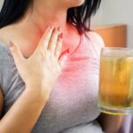 reflux gastrique 1