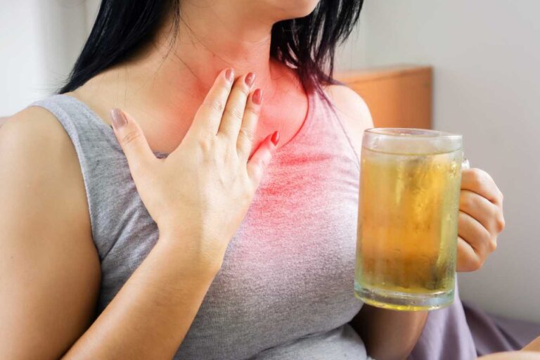 reflux gastrique 1