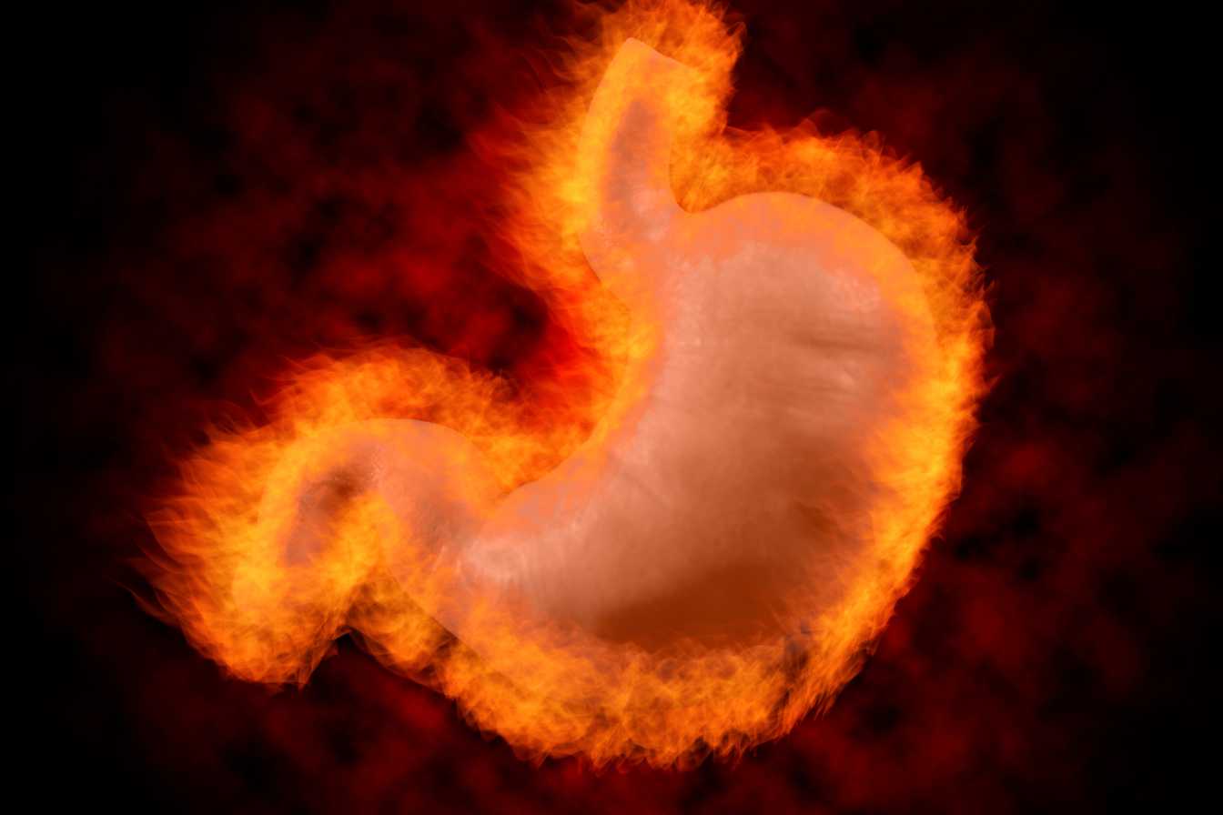 reflux-gastrique-3